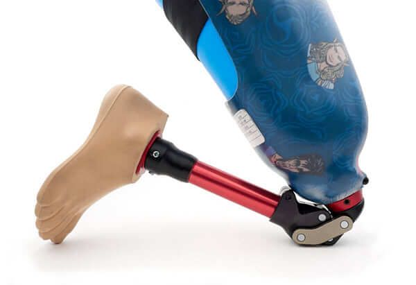 mKnee Explore pediatric prosthetic knee