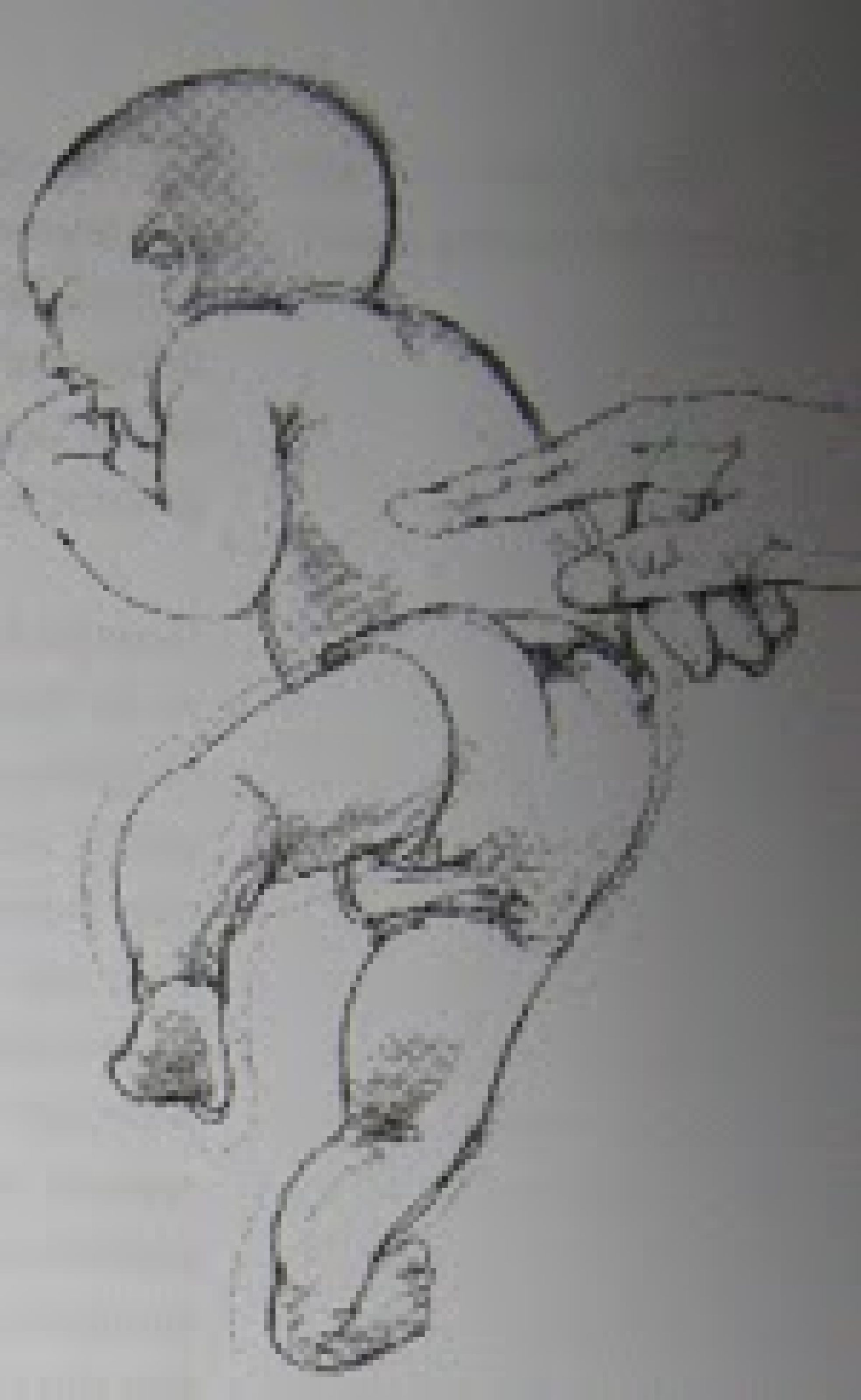 spinale galant reflex